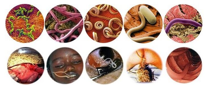 Types de parasites