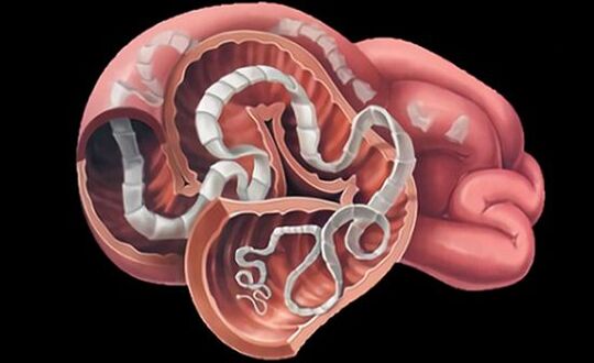 Parasites dans les intestins