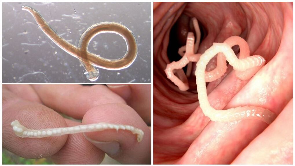 Types de parasites dans le corps