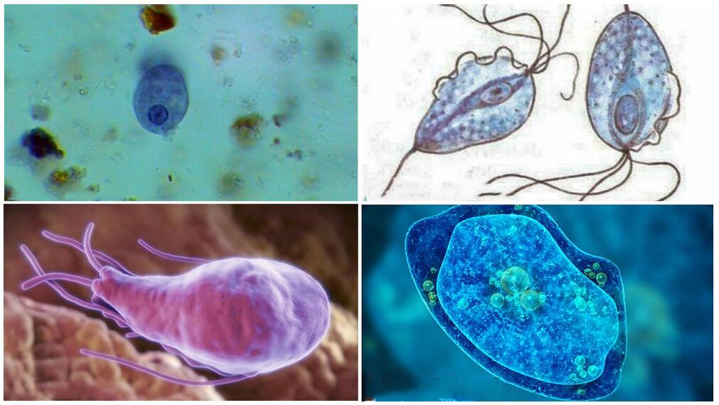 Variétés de parasites