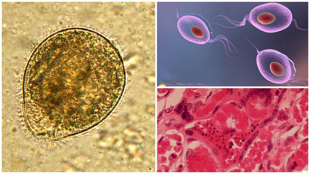 À quoi ressemblent les parasites